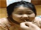 韩国女孩拔牙动态图：小女孩拔牙后表情动态